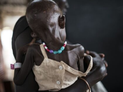 Severely malnourished Nyajuba, 2, is held by her mother, Elizabeth Garyang, as she is weig